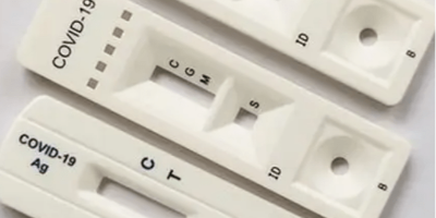 激光打標設備加工的優勢分析